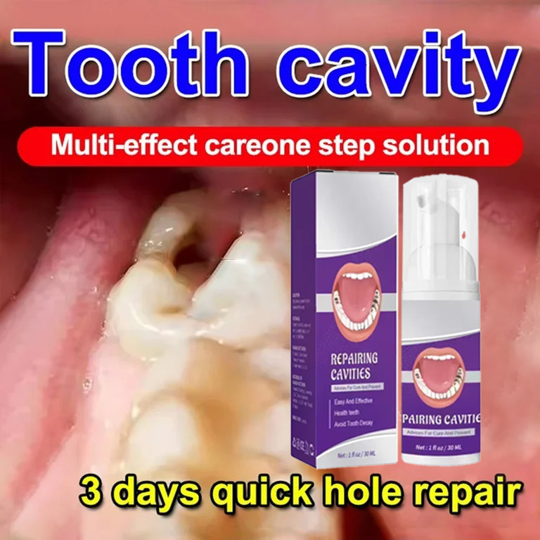 Teeth Whitening Treatment - معجون أسنان لتنظيف الأسنان يزيل بقع