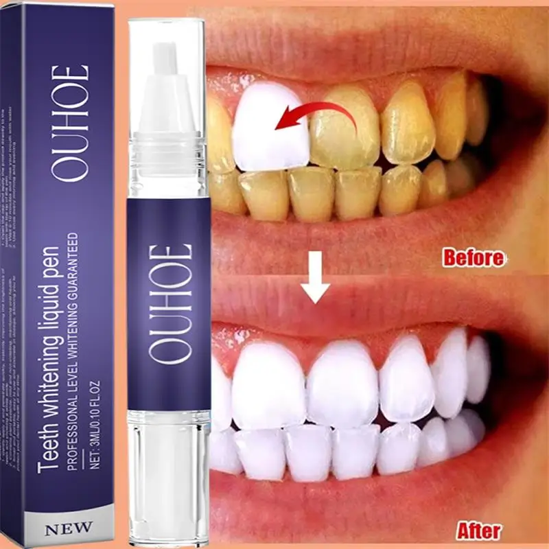 Whitening Pen Bleach - قلم معجون أسنان سريع لتبييض الأسنان