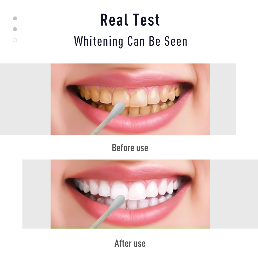 قلم جل للتبييض Tslm2 ، شرائط ن - مراجعة Whitening Pen Bleach وسعره
