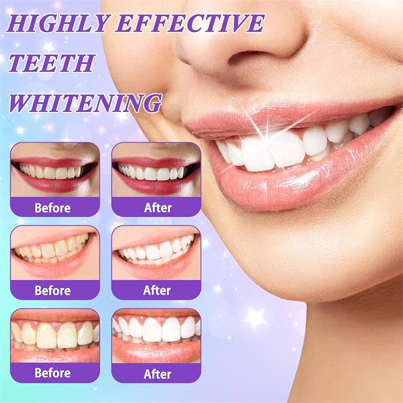 معجون أسنان 9D بنفسجي لتبييض ا - مراجعة Teeth Whitening Treatment وسعره