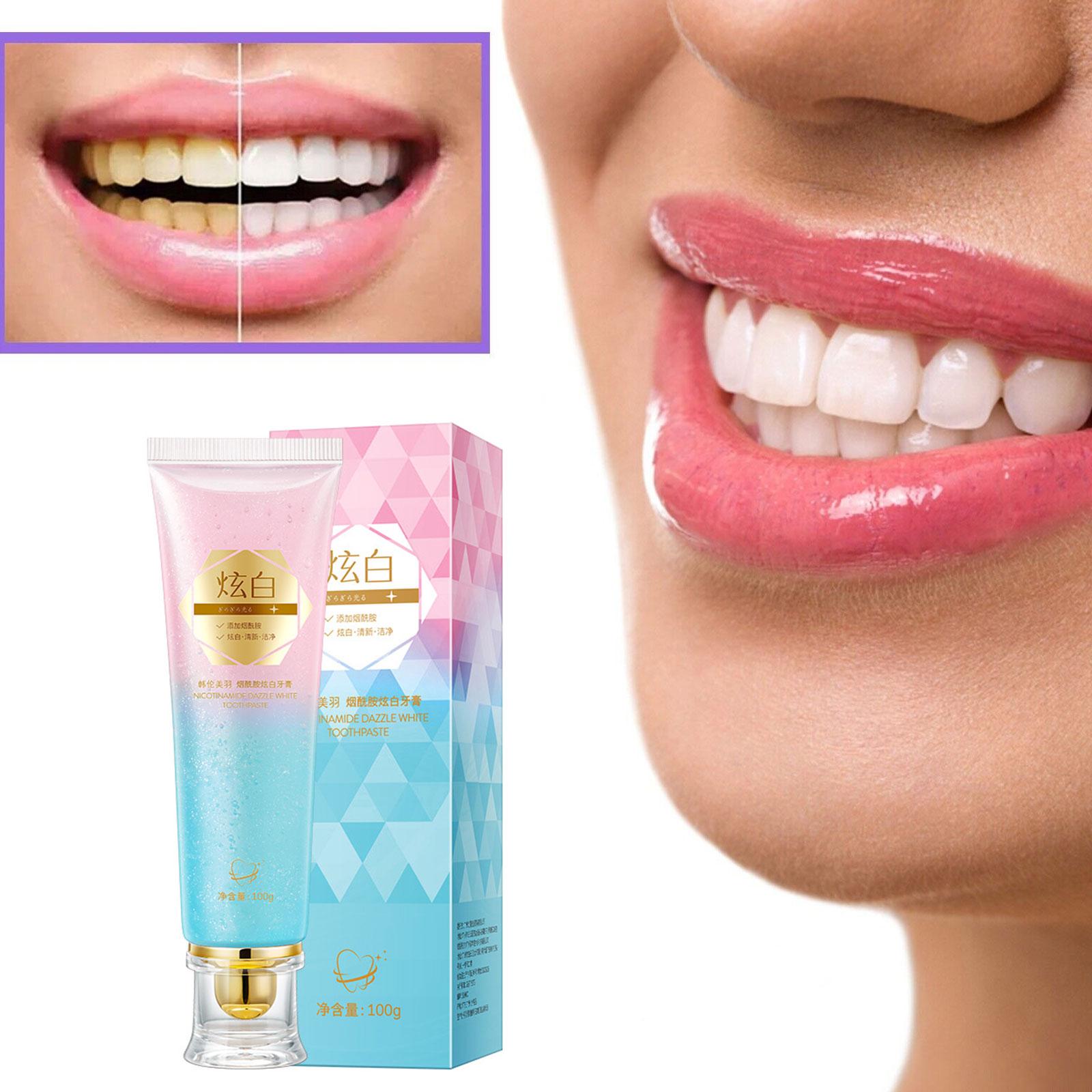 معجون أسنان مبيض النياسيناميد  - مراجعة Teeth Whitening Treatment وسعره
