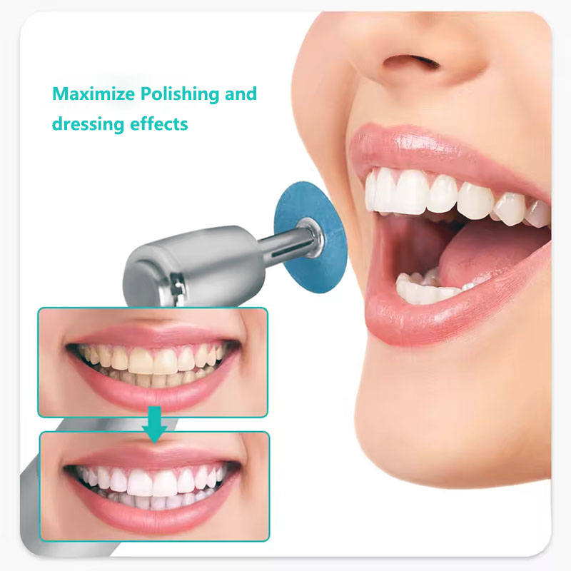 40 قطعة أقراص تلميع الأسنان عق - مراجعة Whitening Teeth Dentist وسعره