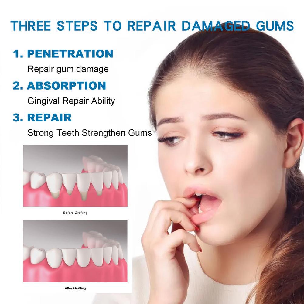 معجون أسنان للعناية بالأسنان،  - مراجعة Teeth Whitening Treatment وسعره