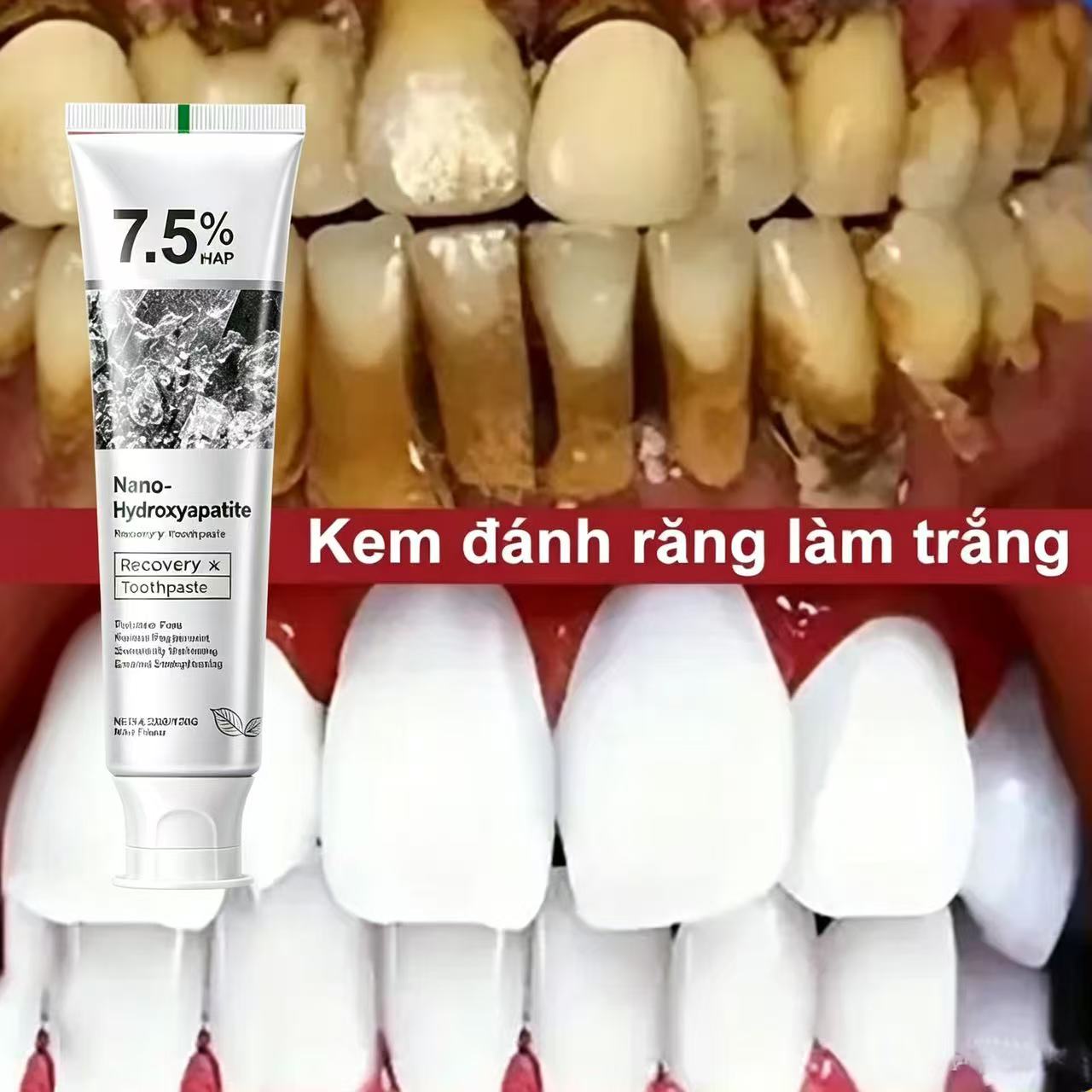 معجون أسنان مبيض بالبروبيوتيك  - مراجعة Teeth Whitening Best وسعره