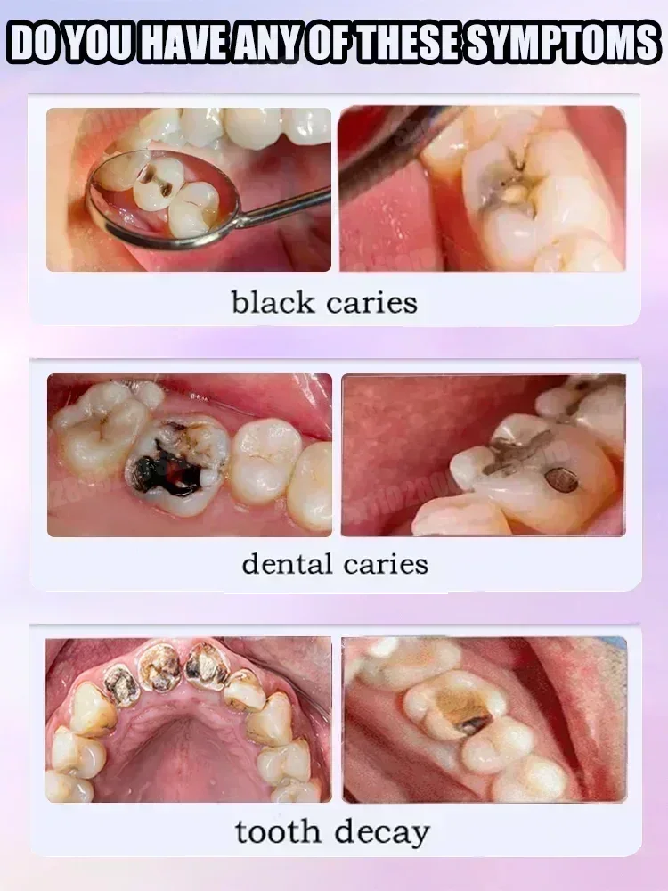 معجون أسنان لتنظيف الأسنان يزي - مراجعة Teeth Whitening Treatment وسعره