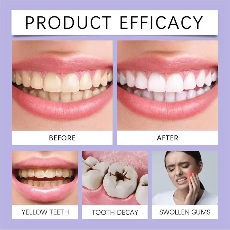 قلم معجون أسنان سريع لتبييض ال - مراجعة Whitening Pen Bleach وسعره
